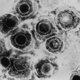 Illustration for article titled New Vaccine Proven Effective Against Genital And Oral Herpes Viruses